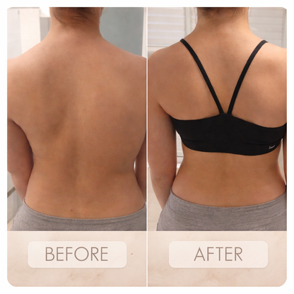 Bacqueen Posture Corrector