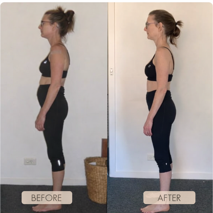 Bacqueen Posture Corrector